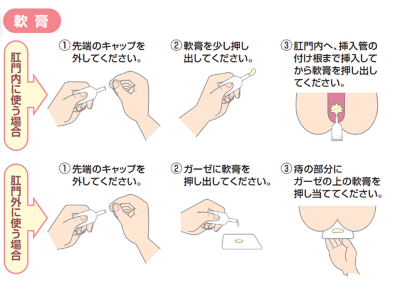 おしりの病気14