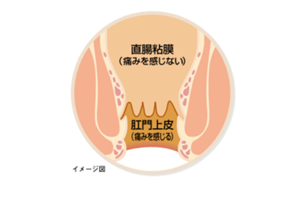 肛門組織2